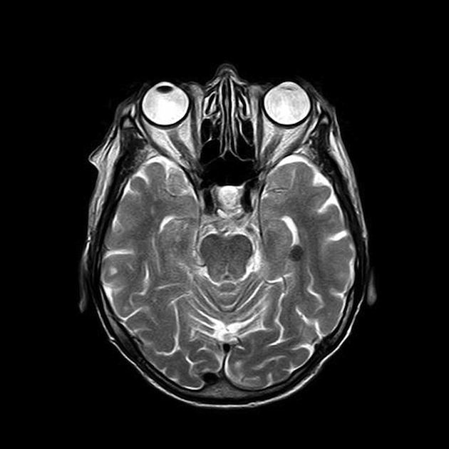 What You Need To Know About Concussion Rockin Mama™