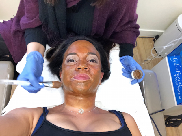 Applying Cosmelan Peel