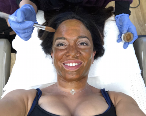What You Need To Know About the Cosmelan Peel - Rockin Mama™