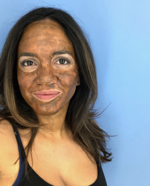 What You Need To Know About the Cosmelan Peel - Rockin Mama™