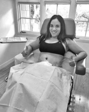 What You Need To Know About Recovering From a Tummy Tuck - Rockin Mama™