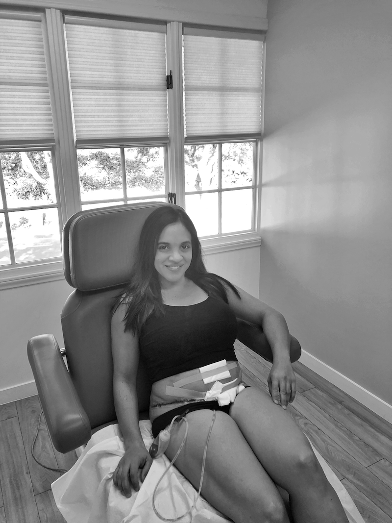 What You Need To Know About Recovering From a Tummy Tuck Rockin Mama™