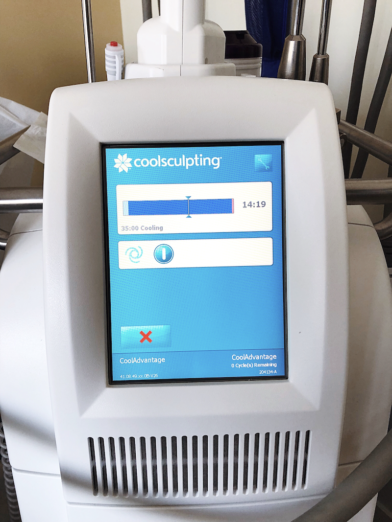 What is CoolSculpting? - Rockin Mama™