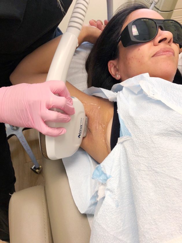 Laser Hair Removal